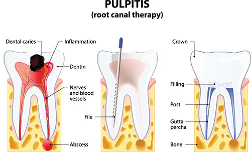 Henry Young, D.D.S. | Dental Bridges, Implant Dentistry and Dental Fillings